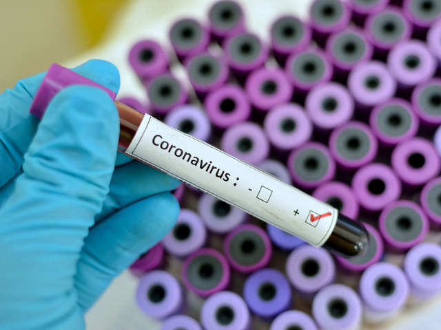5 703 са новите случаи на коронавирус у нас за
